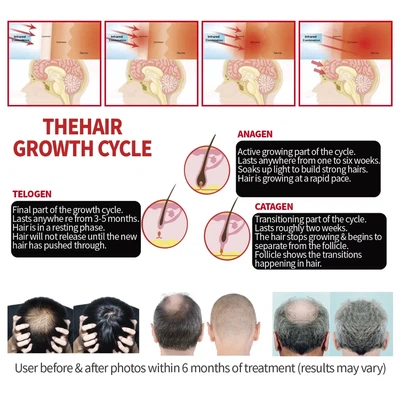 hair growth led cap hair growth led cap